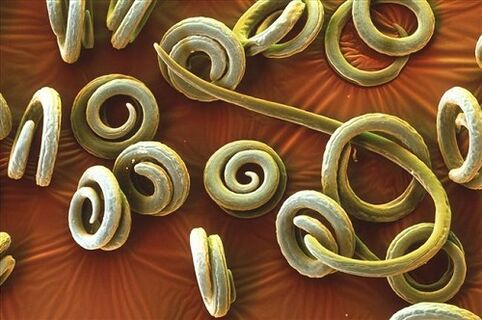 menschliche Priquinella-Parasiten
